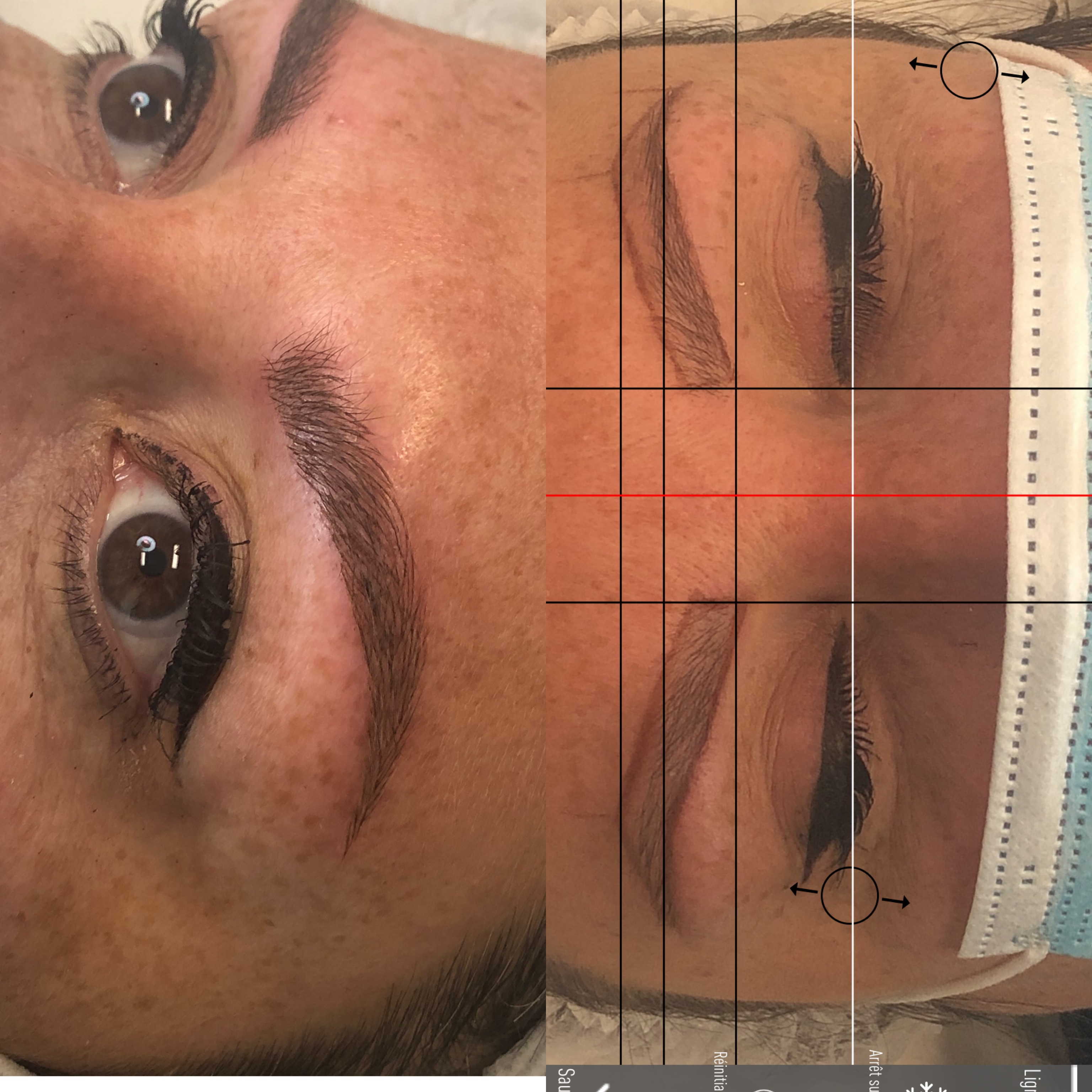 Images Clinique d'Esthétique Leila - Hydrafacial, Microblading, Épilation Laser Sainte-Foy