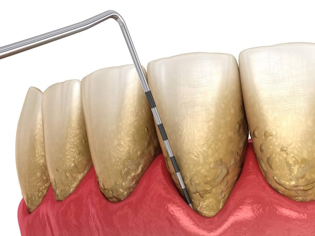 Images Elevate Dental Wellness