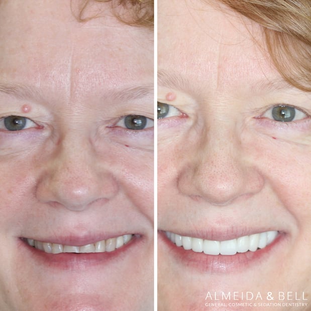 Images Almeida & Bell Dental Lone Tree - General, Cosmetic, and Implant Dentistry