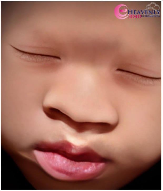 Images Heavenly 3D 4D Ultrasounds