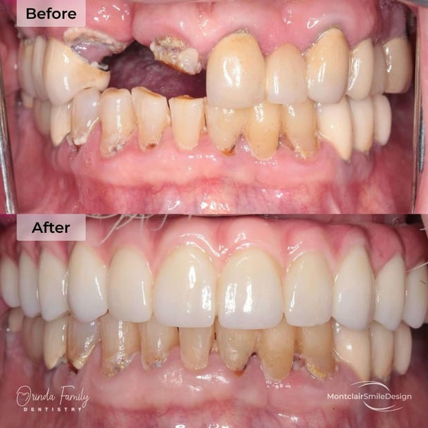 Images Orinda Family Dentistry