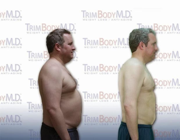 Images TrimBody M.D. Summerlin