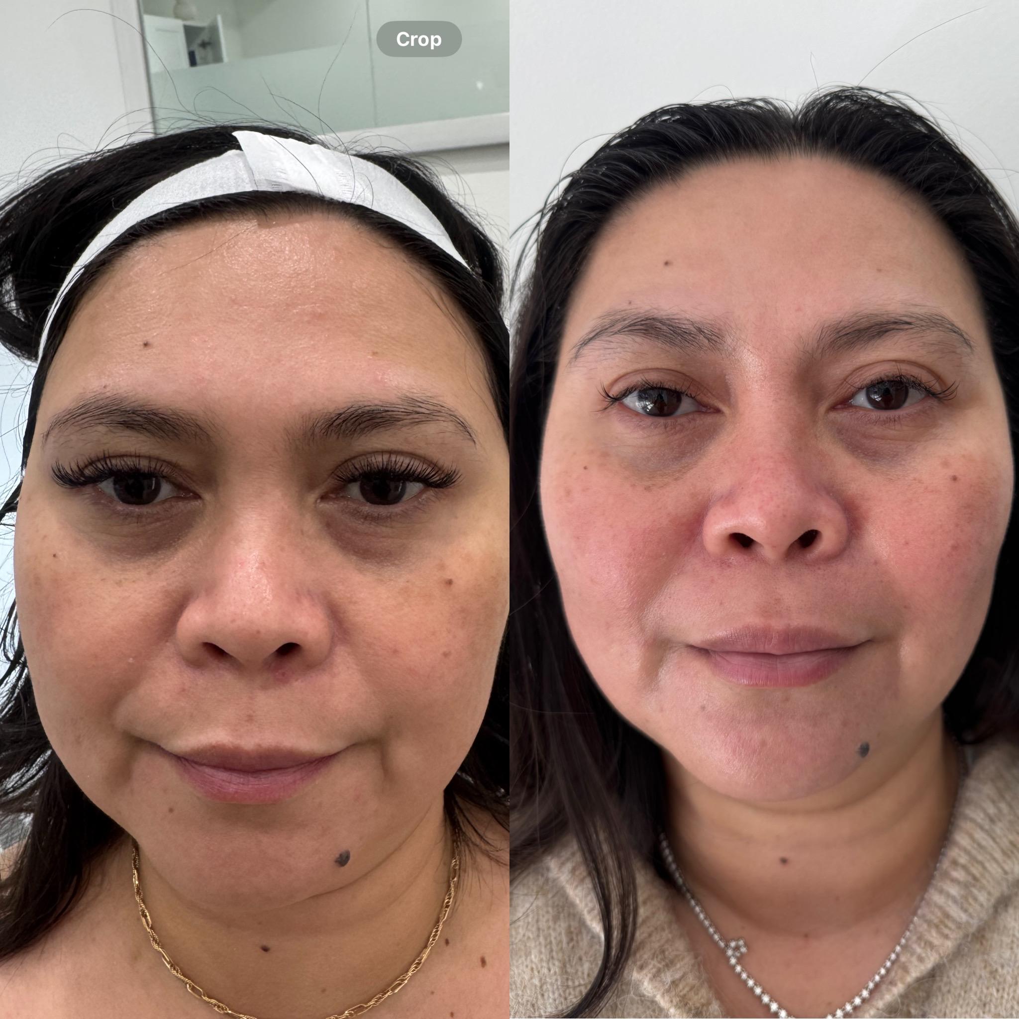 Images Luminous Skin