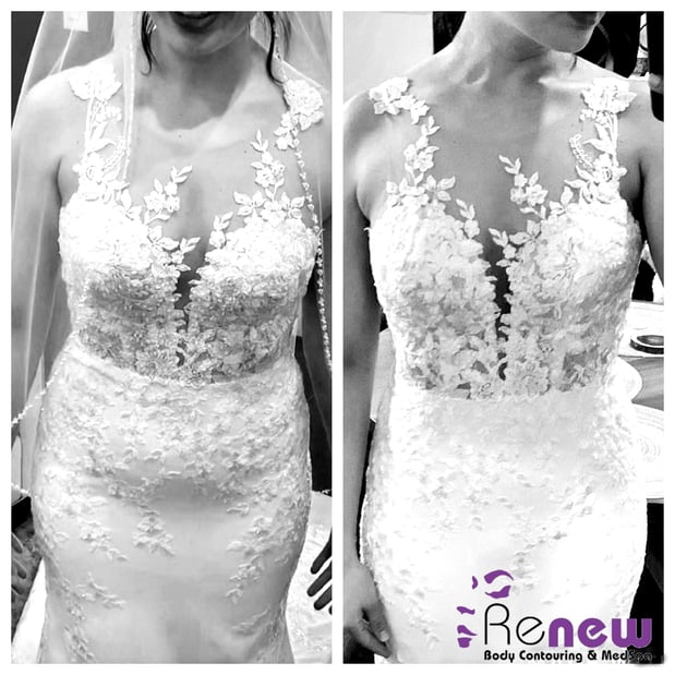 Images Renew Body Contouring & MedSpa