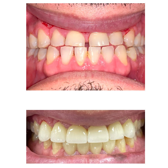Cortes Family Dentistry- Ortodoncia