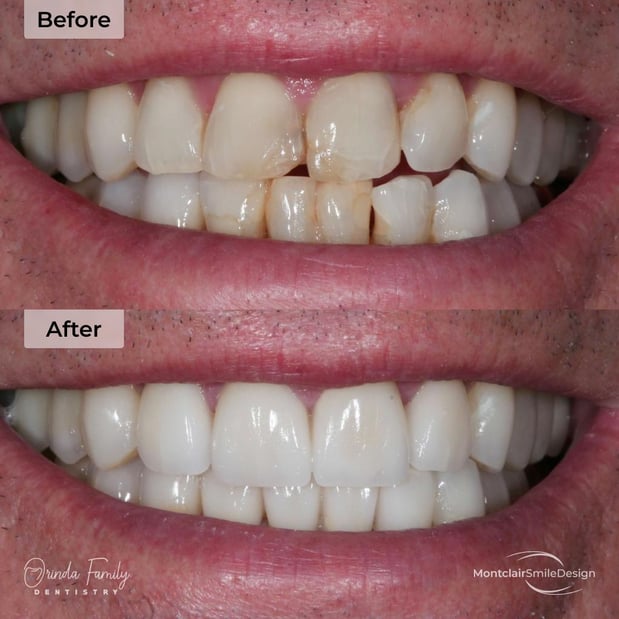 Images Orinda Family Dentistry