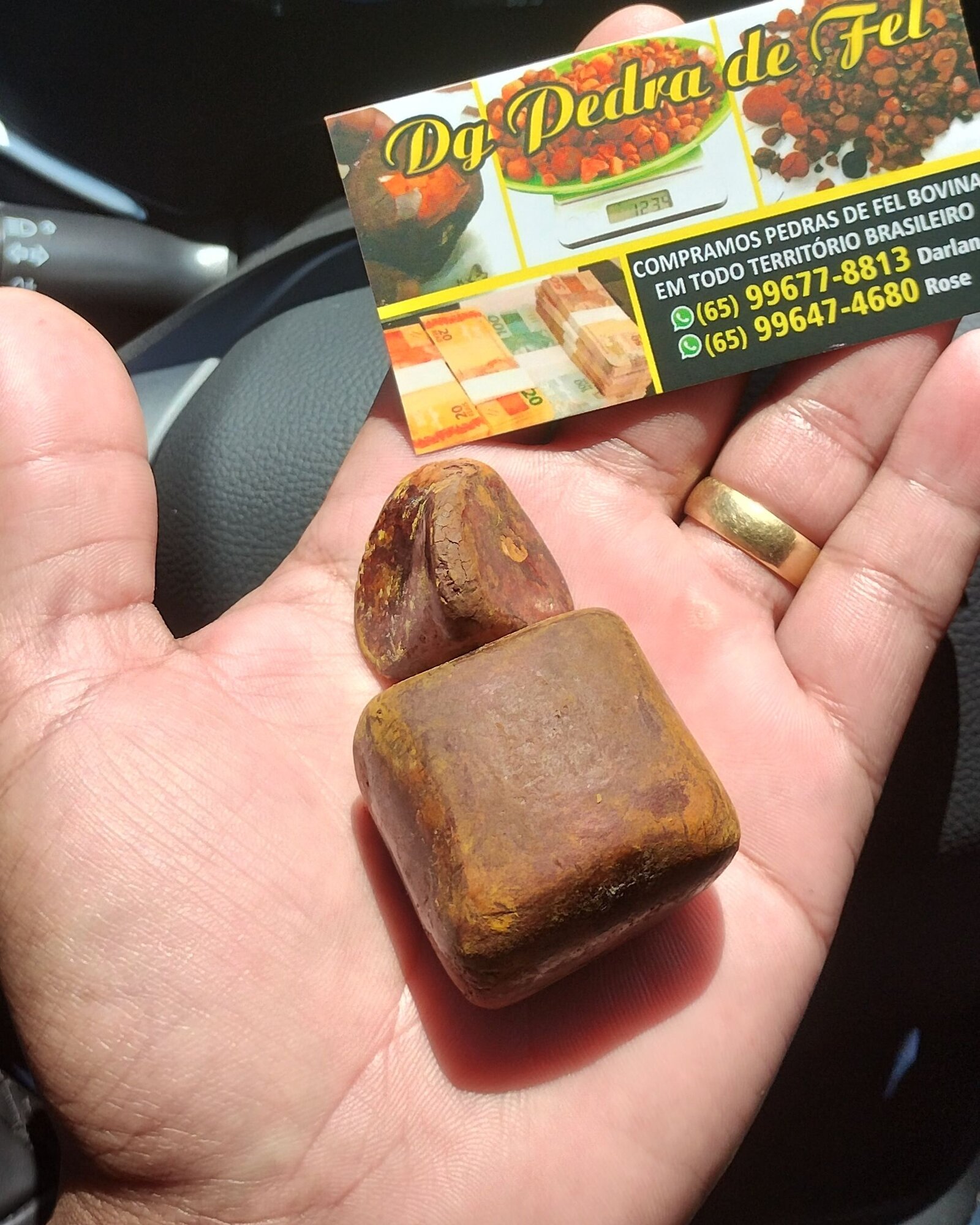 Images Dg pedras de fel bovinos