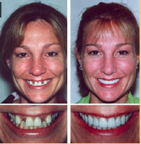 Images Springdale Family Dental