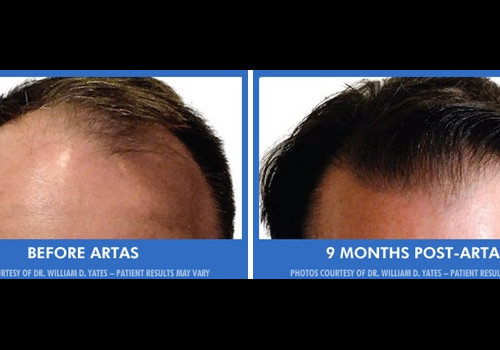 Austin Hair Restoration Clinic Photo