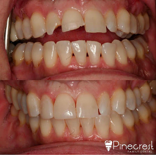 Images Pinecrest Family Dental