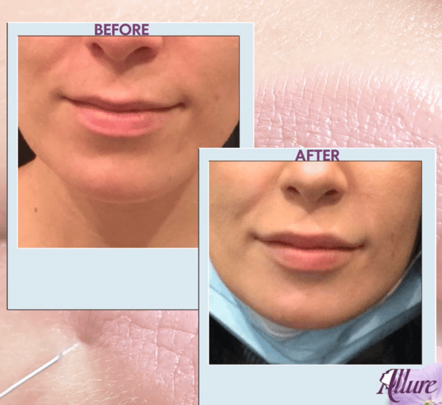 Images Allure Laser & Med Spa