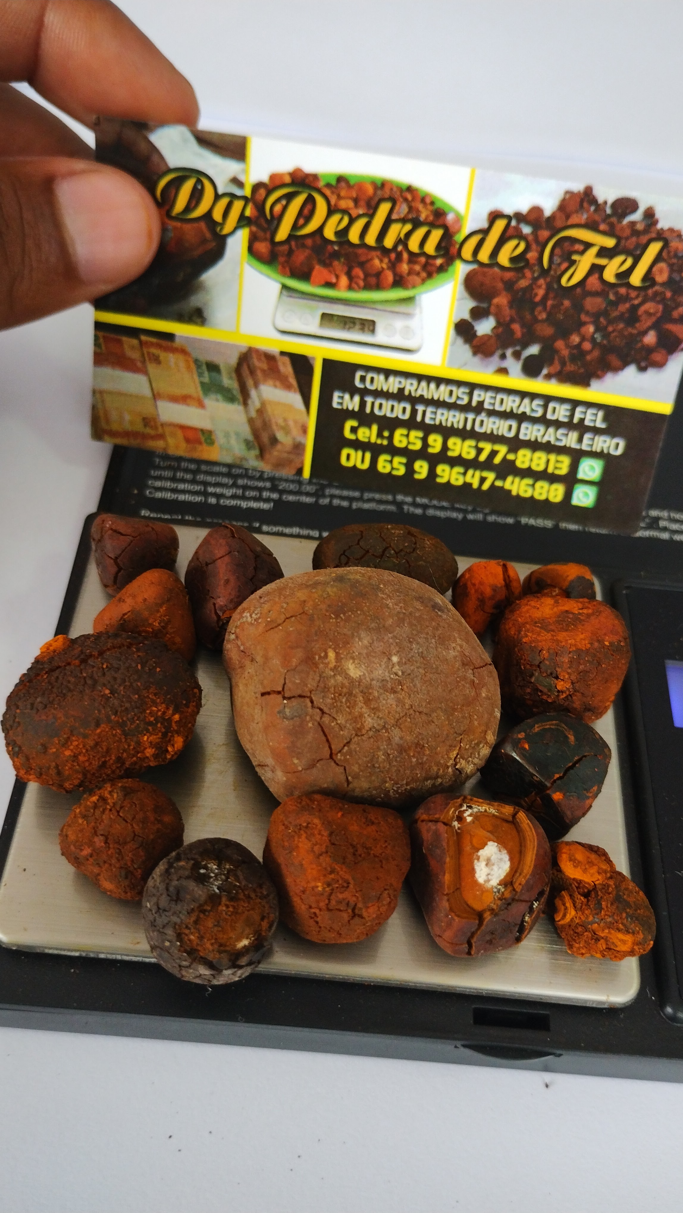 Images Dg pedras de fel bovinos