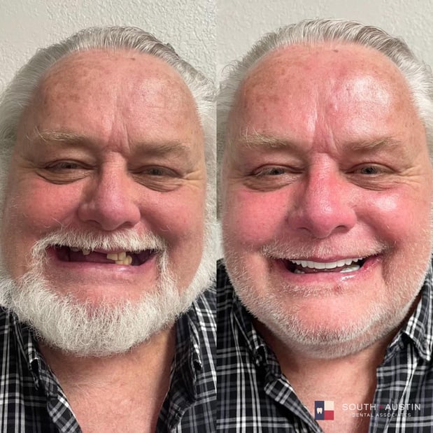 Images South Austin Dental Associates