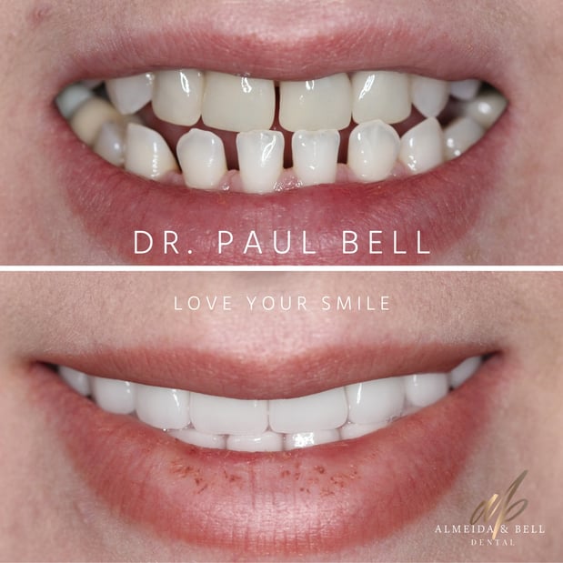 Images Almeida & Bell Dental Lone Tree - General, Cosmetic, and Implant Dentistry