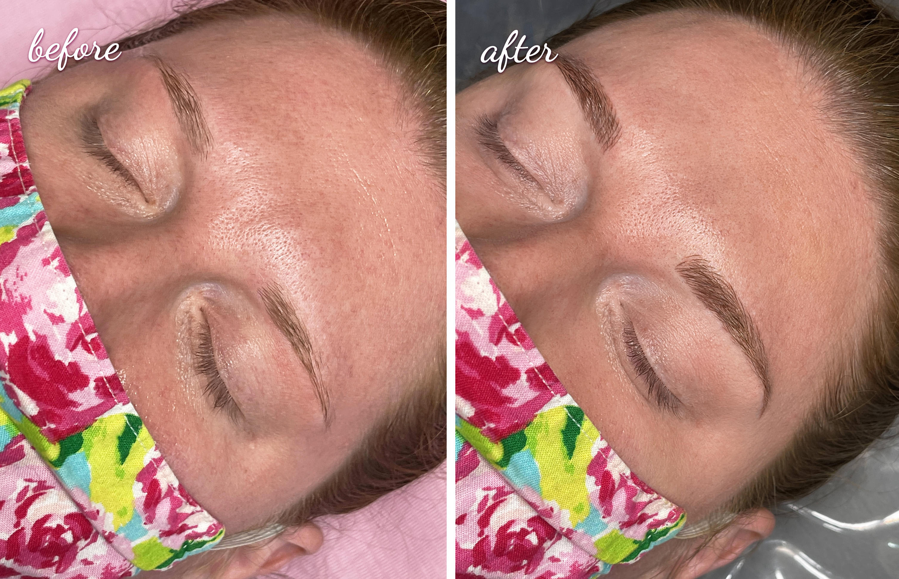 Microblading Before After at Laveda Lash & Brow