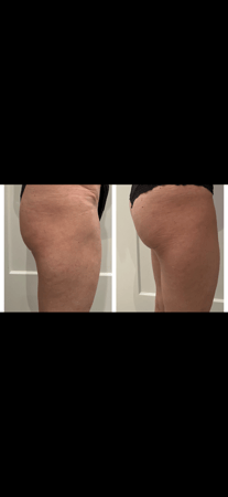 Images Body Lounge Park Cities - Whole Body Wellness & Medical Aesthetics, Dallas, TX