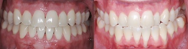 Images Mountainview Periodontics