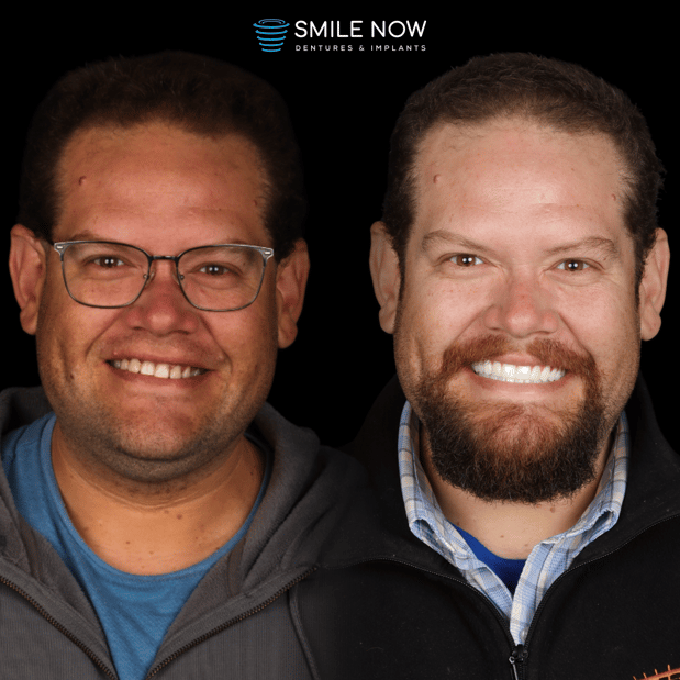 Images Smile Now Milwaukee Dentures and Implants