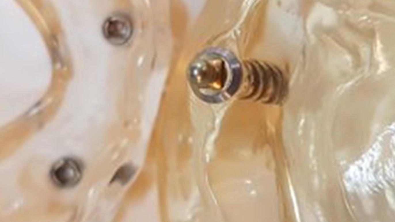 Images Kliniske Tandteknikere Linda Holst & Christian Boljanac