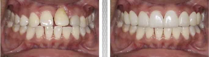 Images WestLake Dental Care