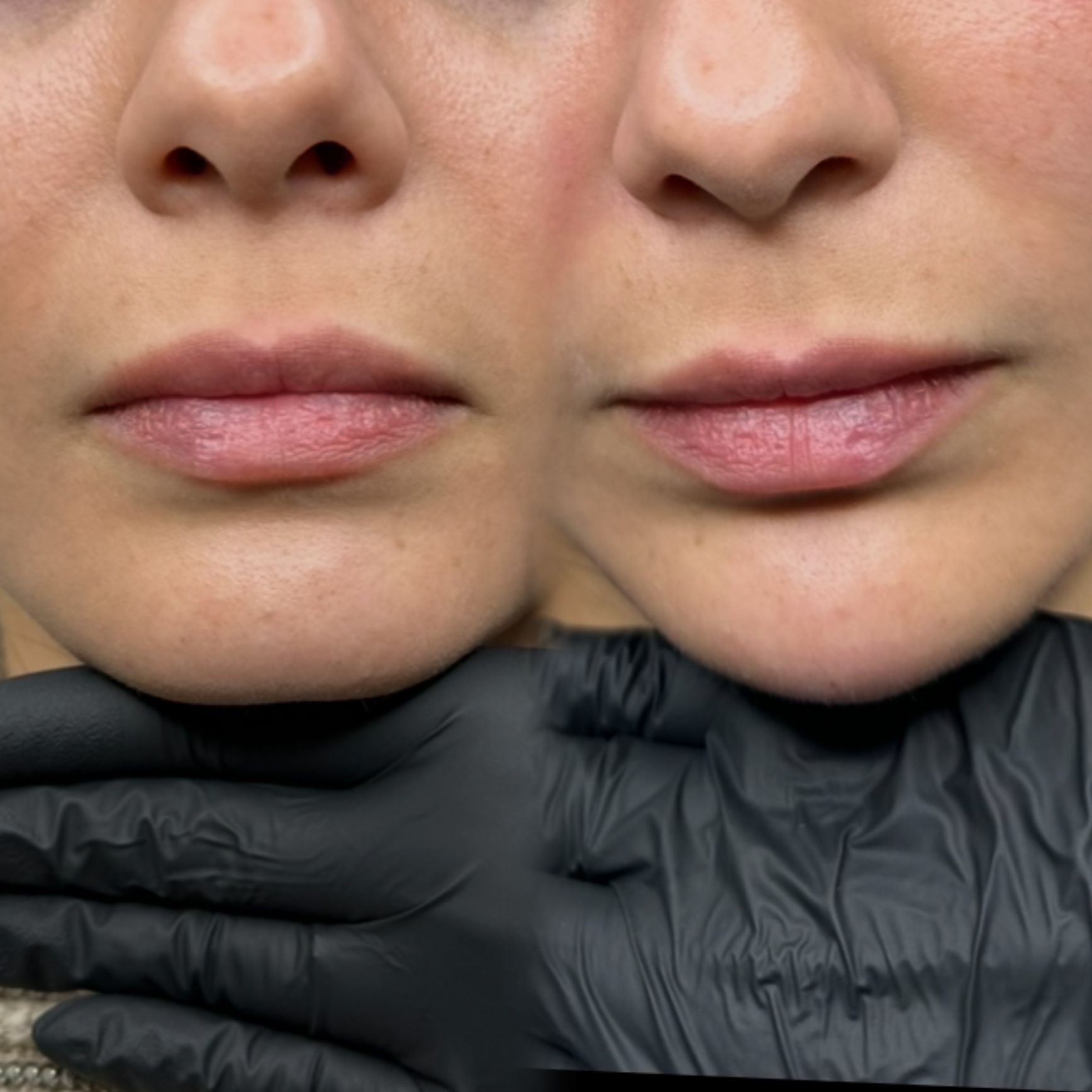 Images Monfer Dermoestetica