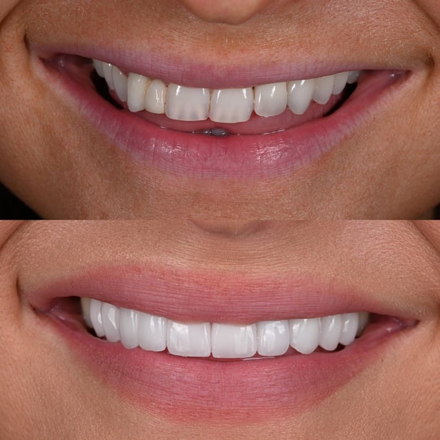 Images White House Aesthetic and Implant Dentistry