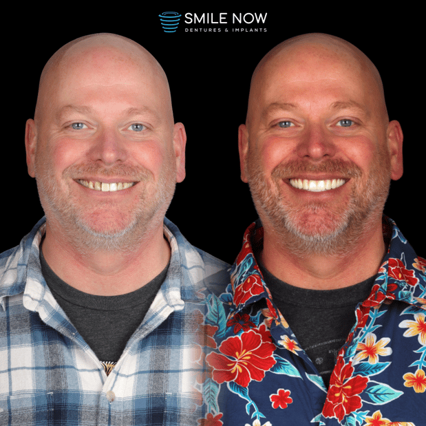 Images Smile Now Milwaukee Dentures and Implants