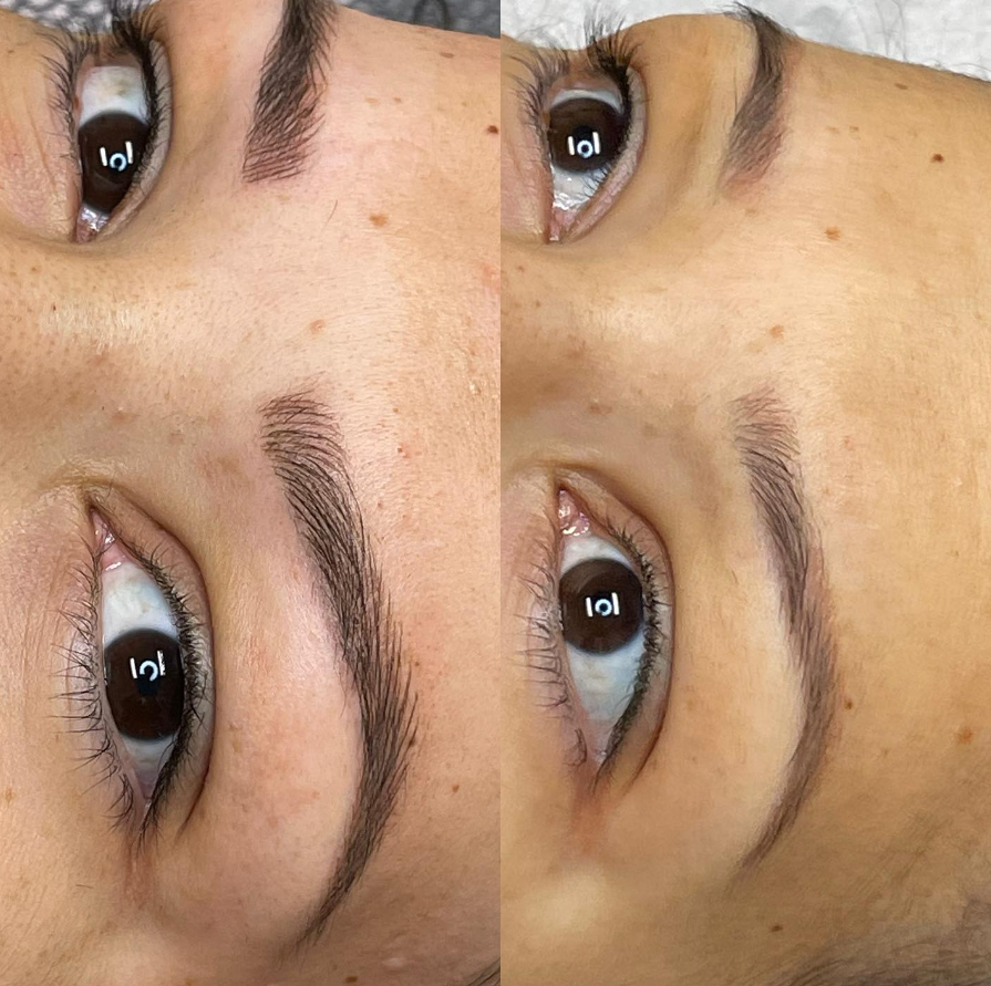 Images Clinique d'Esthétique Leila - Hydrafacial, Microblading, Épilation Laser Sainte-Foy