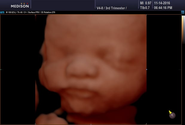 Images Heavenly 3D 4D Ultrasounds