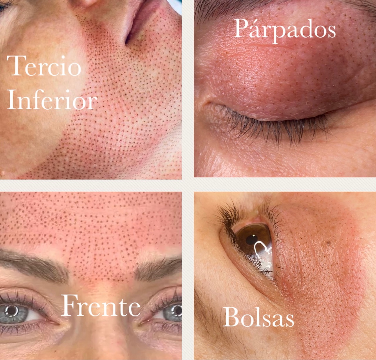 Images Dermalab