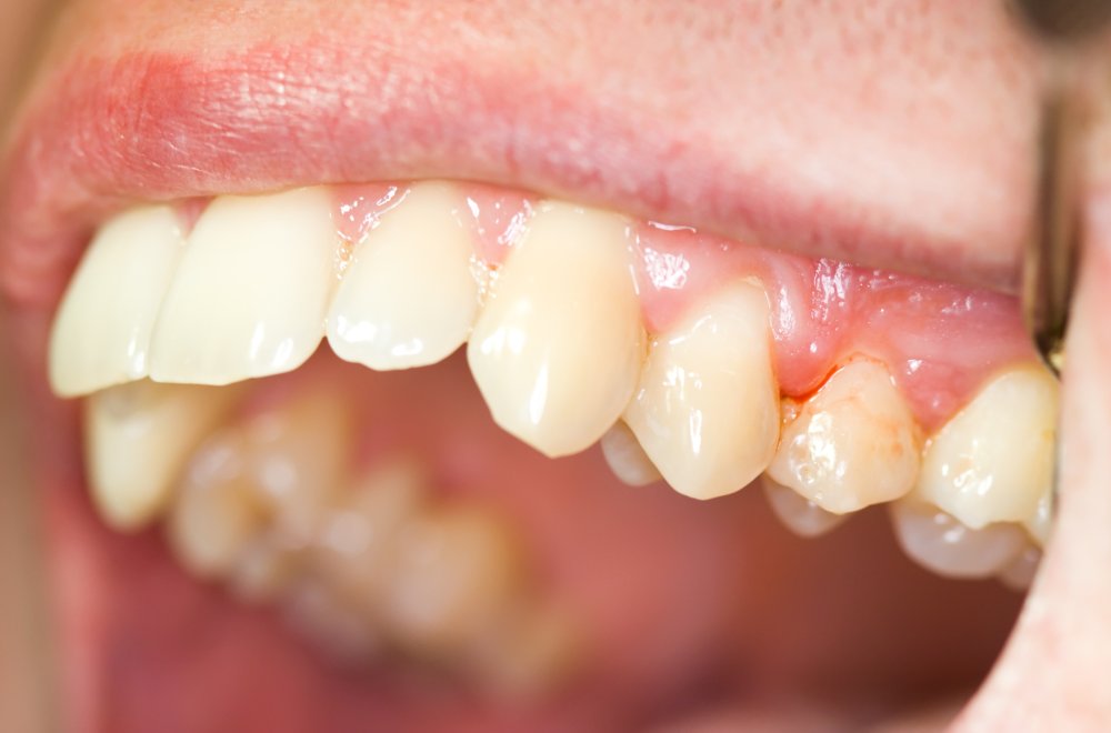 Images Clinique Dentaire Dr. Karam - Dentiste, Blanchiment Dentaire Ahuntsic