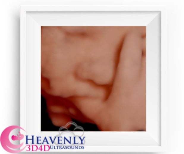Images Heavenly 3D 4D Ultrasounds