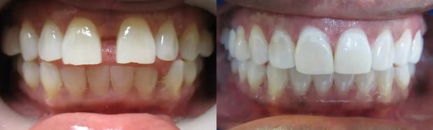 Images Premier Dental of South Orange County