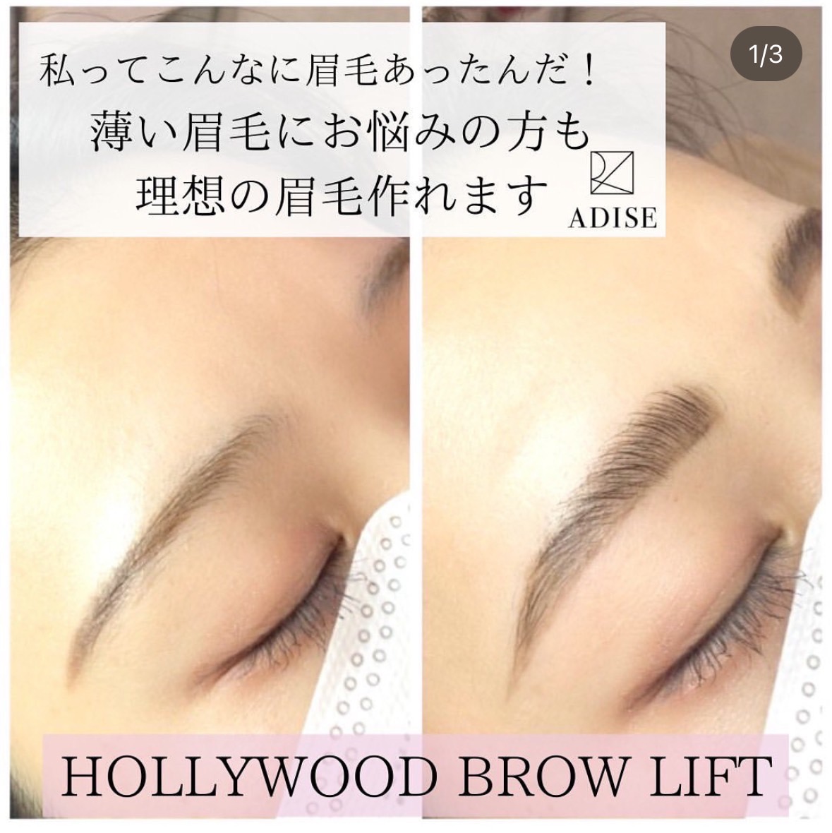 Images アディス リティフル