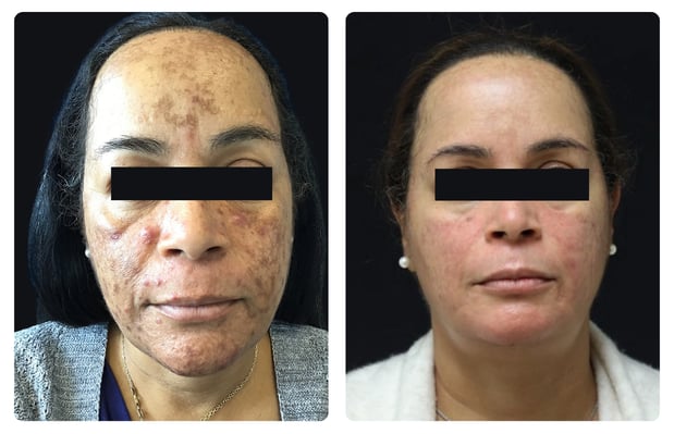 Images Glösense Dermatology & Aesthetic