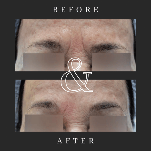 Images Sunkissed Med Spa