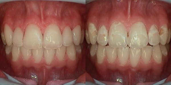 Images Haws Family Dentistry