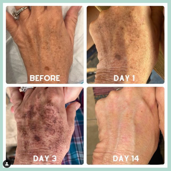 Images MedDerm Dermatology