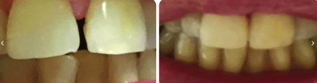 Images Northpointe Smiles