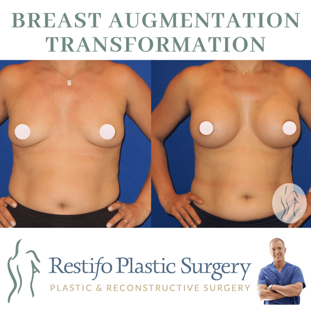 Images Restifo Plastic Surgery