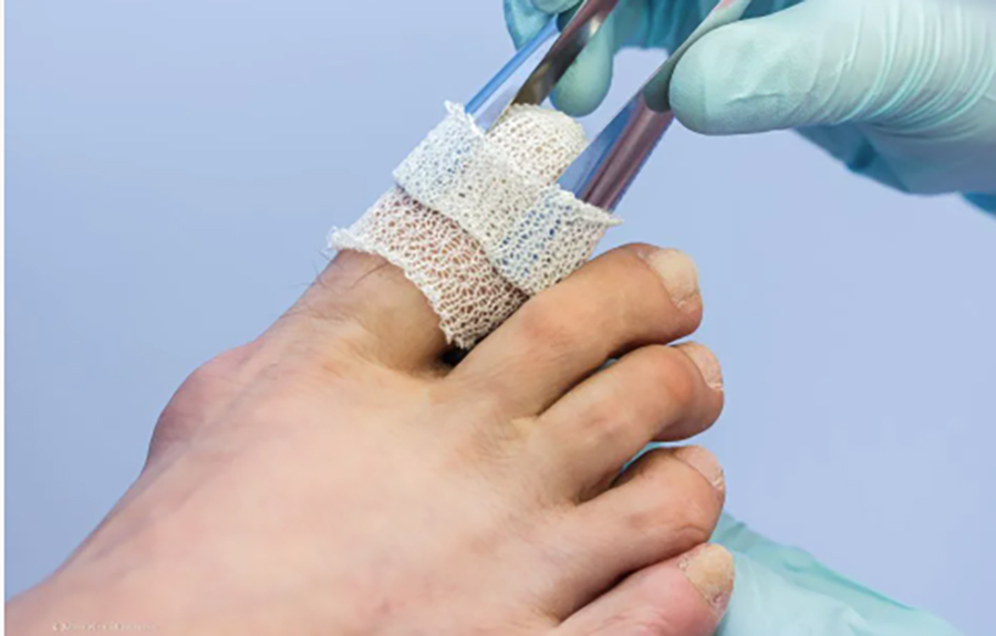 Bild 5 meapodo - Zentrum für Fußgesundheit Katja Hofmann in Pulsnitz