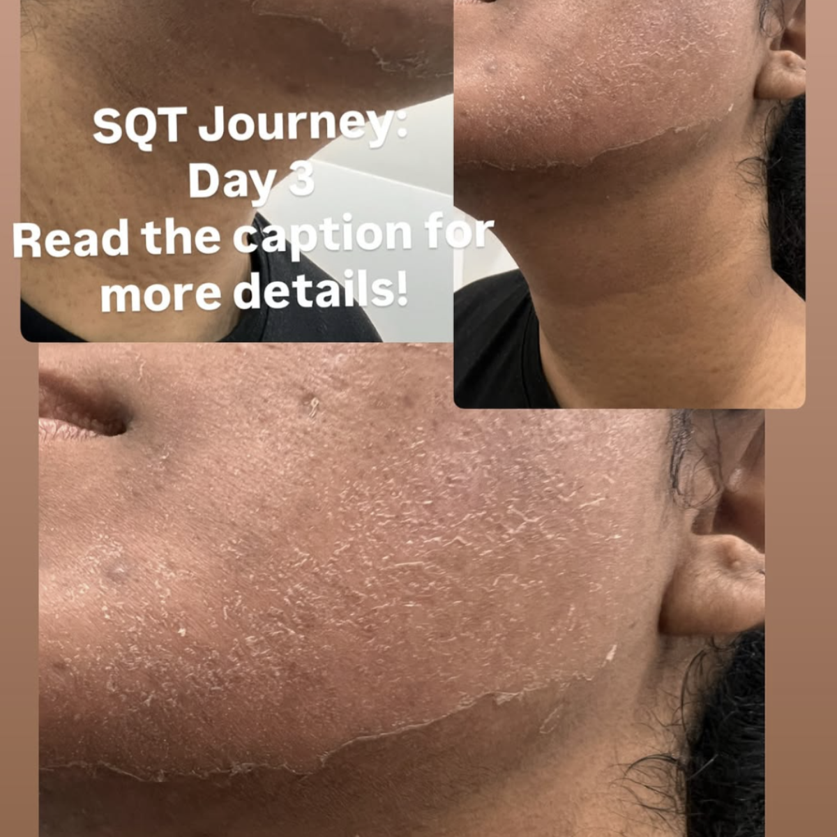 Images DERMA GLOW SOUTH YARRA ( Formerly Known as ALS)