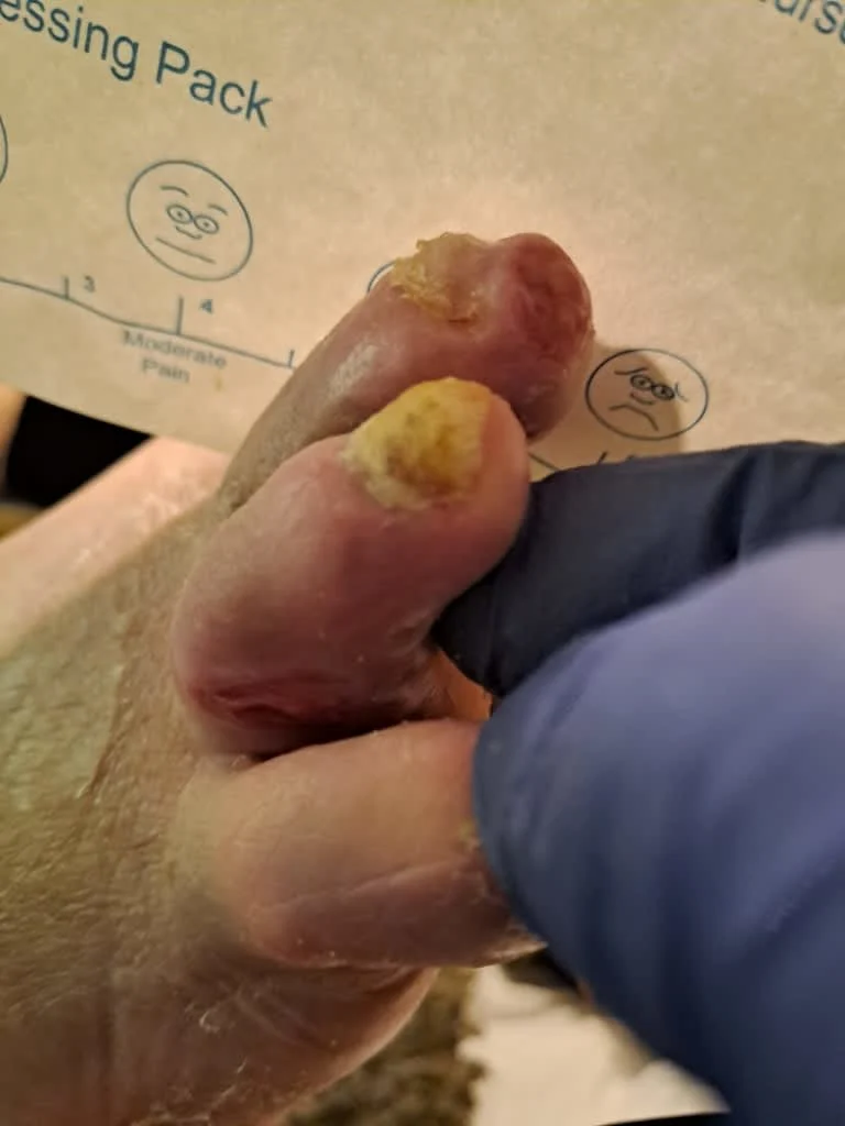 Images Foot Soldiers Podiatry