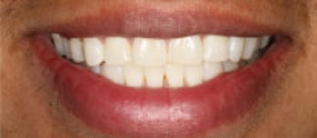 Images Glenlake Dental Care