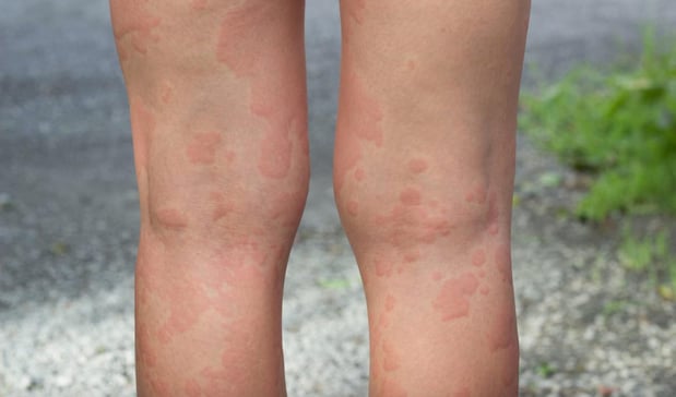 Images Gupta Allergy: Allergy & Asthma Specialists of Lansing, PLLC