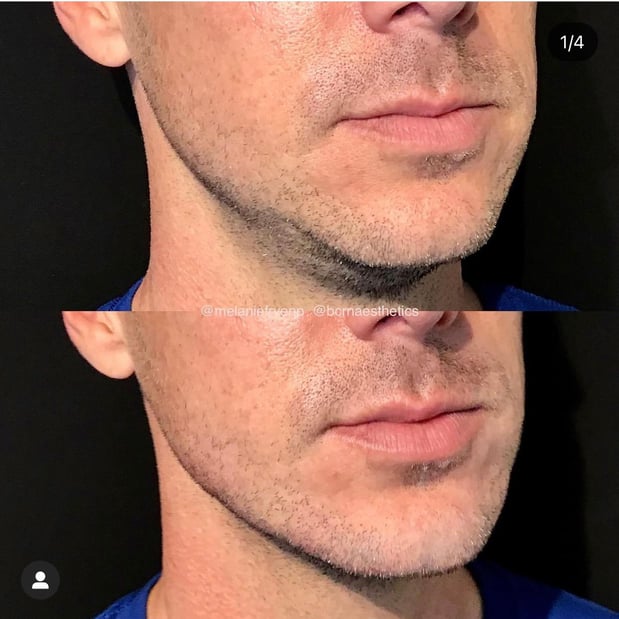 Images BCRN Aesthetics MedSpa