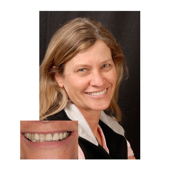 Images San Diego Smiles