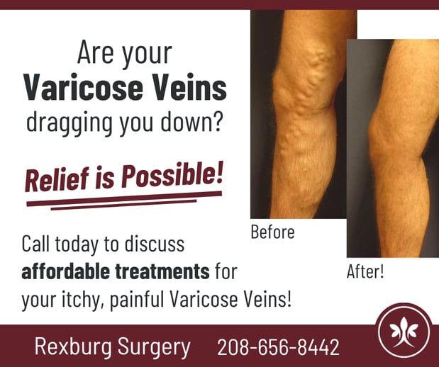 Images Rexburg Surgery