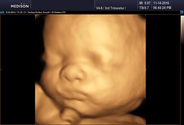 Images Heavenly 3D 4D Ultrasounds