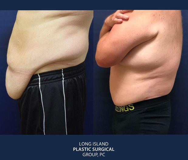 Images New York Plastic Surgical Group, a Division of Long Island Plastic Surgical Group, PC